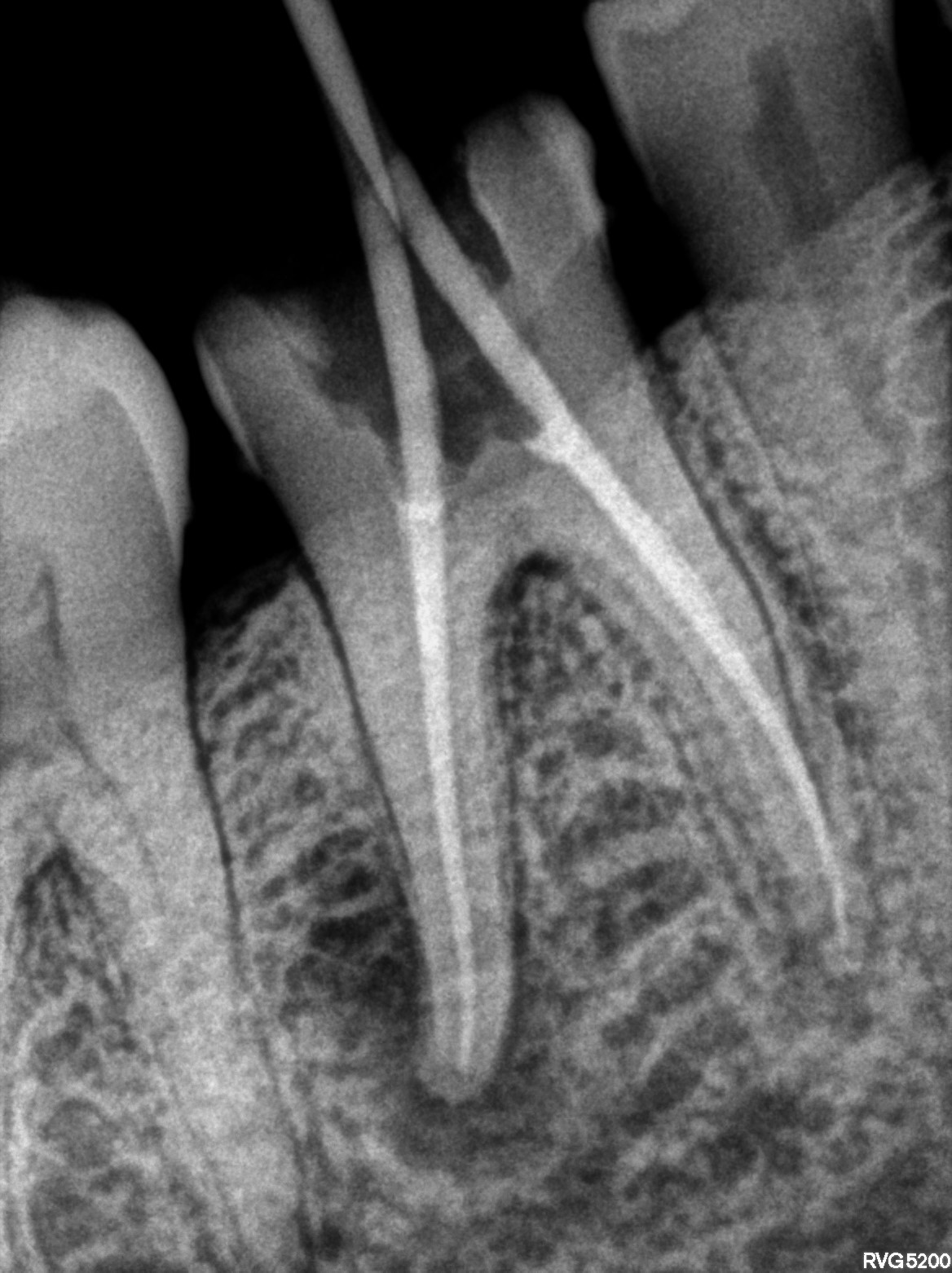 Dental X-ray